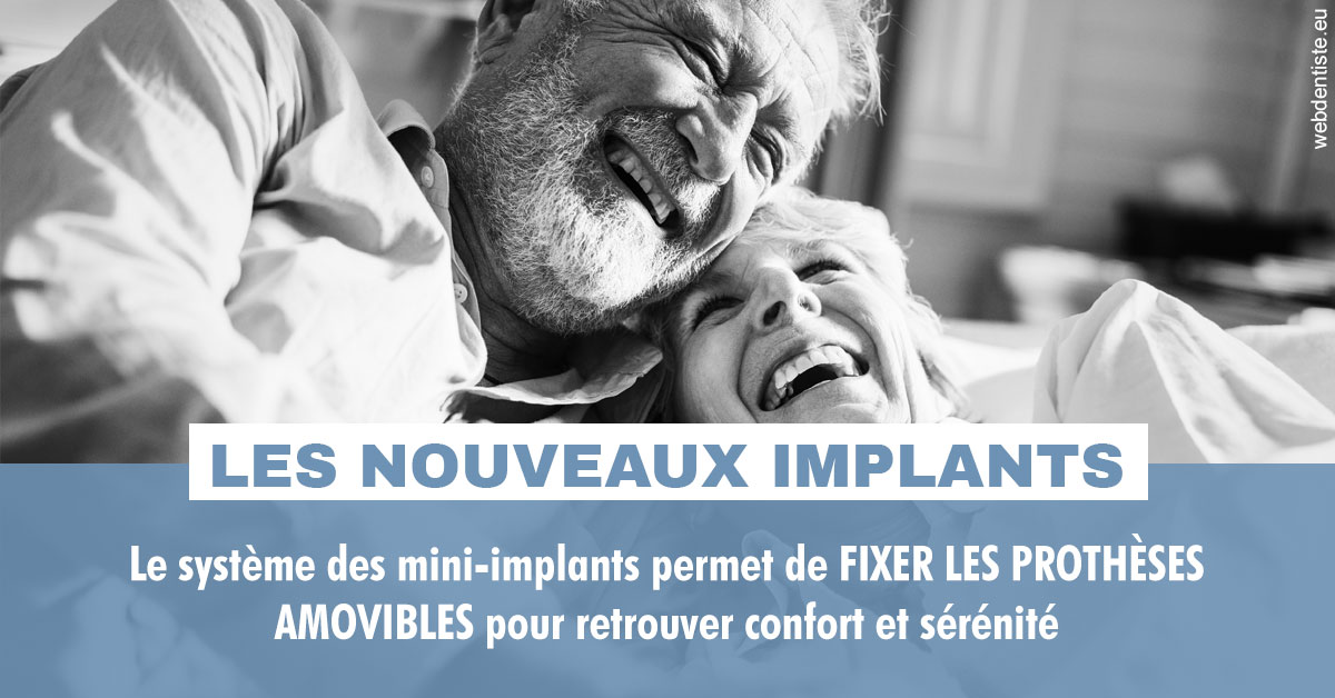 https://dr-fabrice-vernet.chirurgiens-dentistes.fr/Les nouveaux implants 2