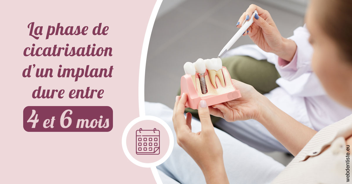 https://dr-fabrice-vernet.chirurgiens-dentistes.fr/Cicatrisation implant 2