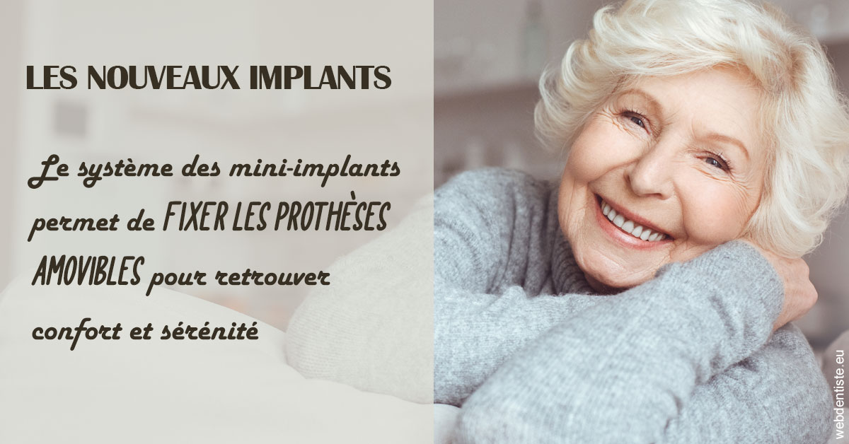 https://dr-fabrice-vernet.chirurgiens-dentistes.fr/Les nouveaux implants 1