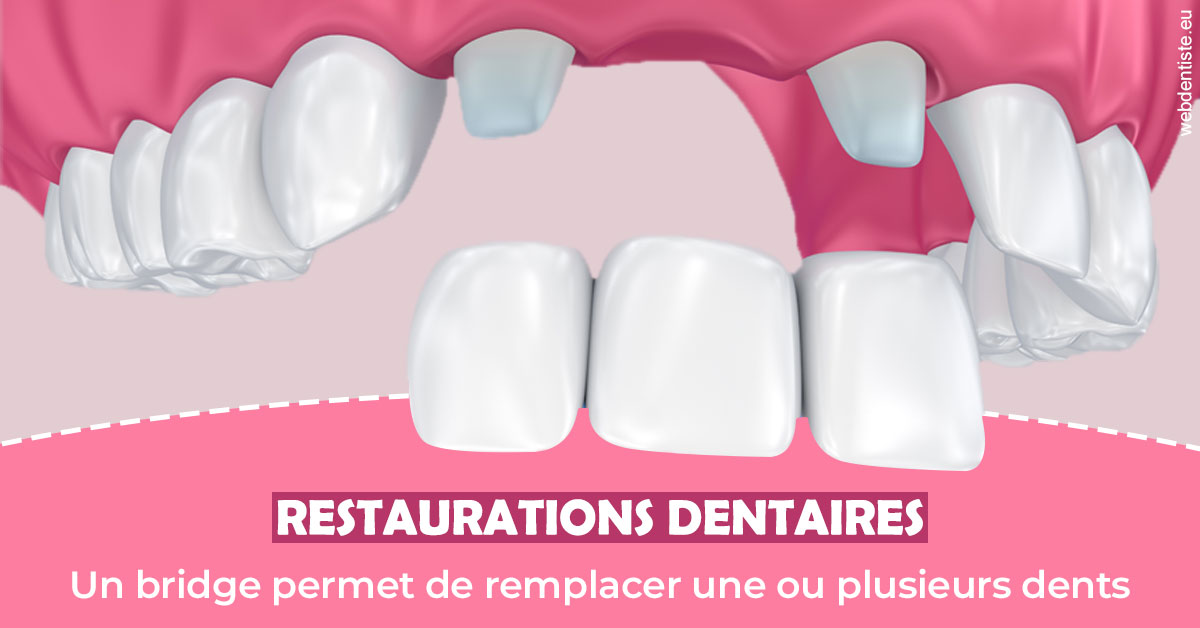 https://dr-fabrice-vernet.chirurgiens-dentistes.fr/Bridge remplacer dents 2