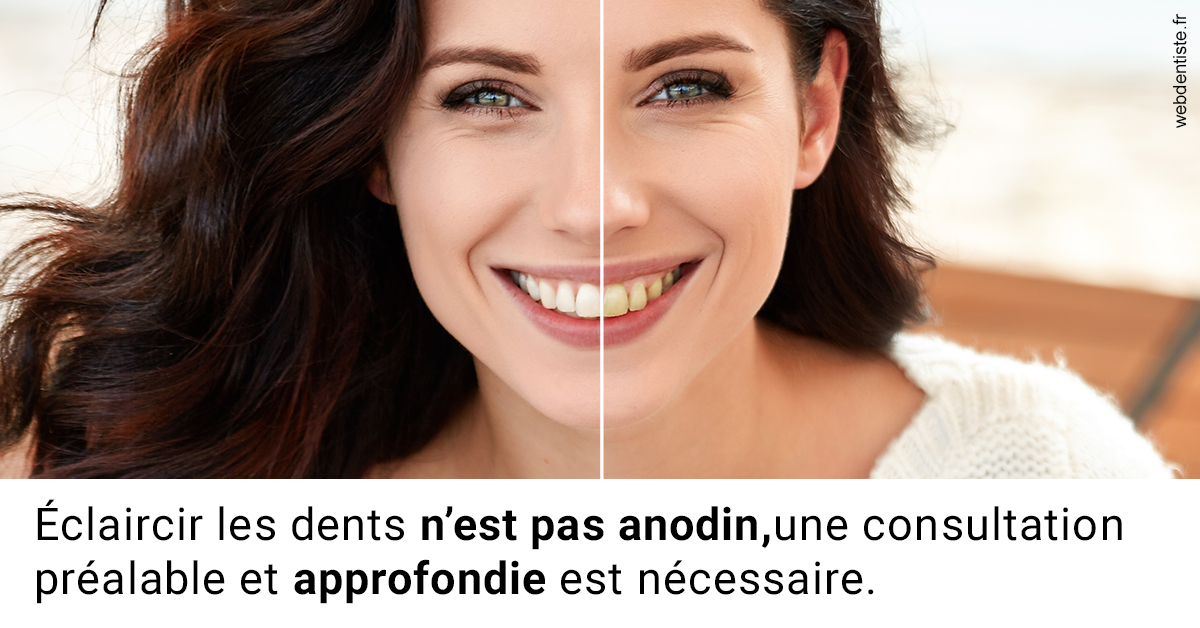 https://dr-fabrice-vernet.chirurgiens-dentistes.fr/Le blanchiment 2