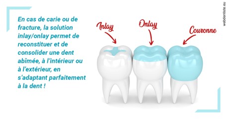 https://dr-fabrice-vernet.chirurgiens-dentistes.fr/L'INLAY ou l'ONLAY