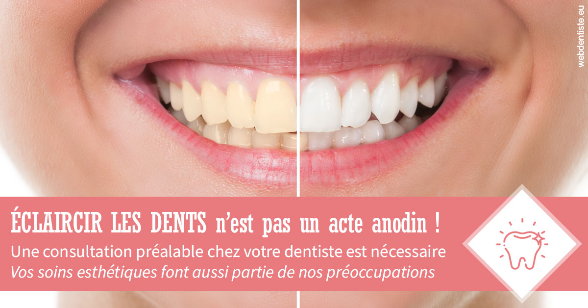 https://dr-fabrice-vernet.chirurgiens-dentistes.fr/Eclaircir les dents 1