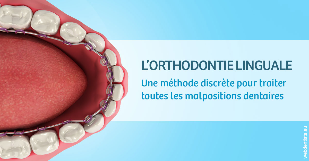 https://dr-fabrice-vernet.chirurgiens-dentistes.fr/L'orthodontie linguale 1
