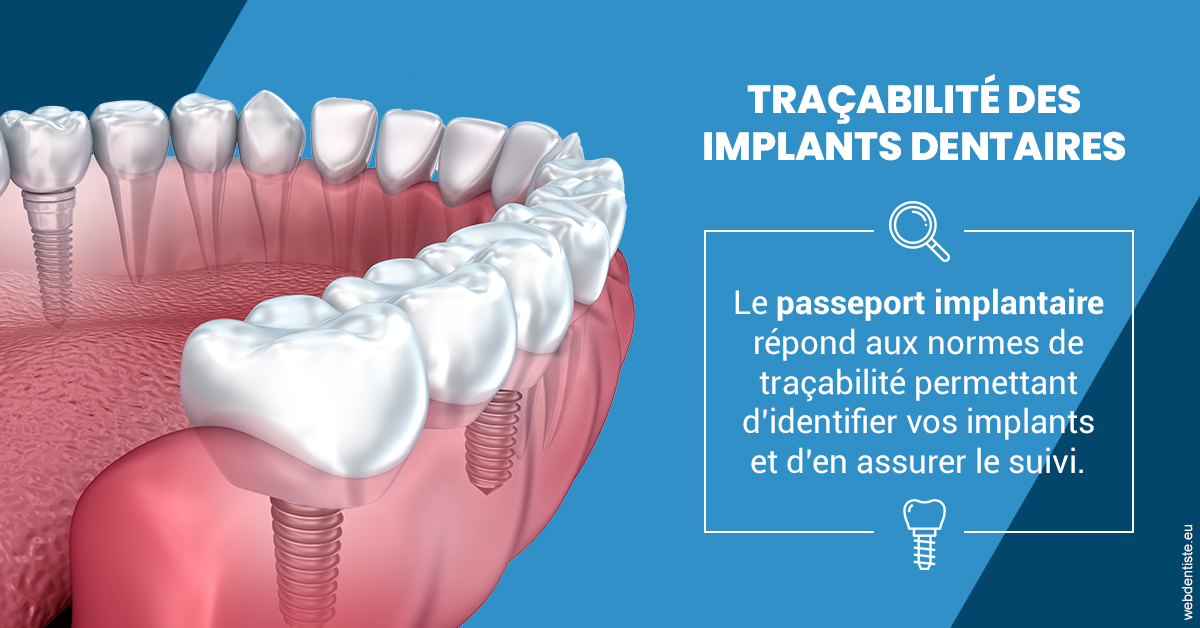 https://dr-fabrice-vernet.chirurgiens-dentistes.fr/T2 2023 - Traçabilité des implants 1