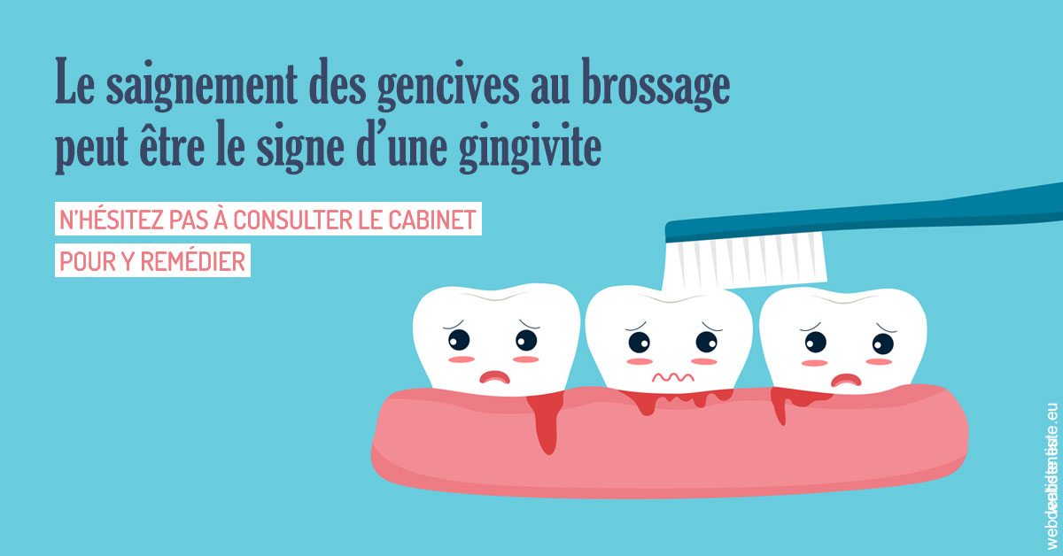 https://dr-fabrice-vernet.chirurgiens-dentistes.fr/Saignement gencives 2