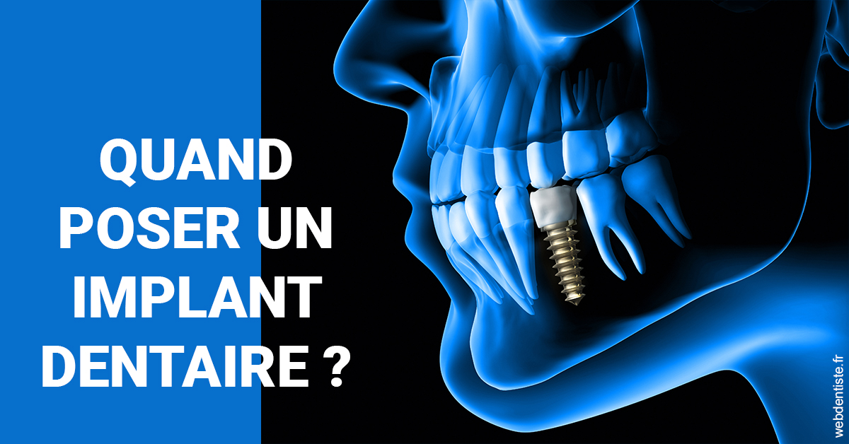 https://dr-fabrice-vernet.chirurgiens-dentistes.fr/Les implants 1