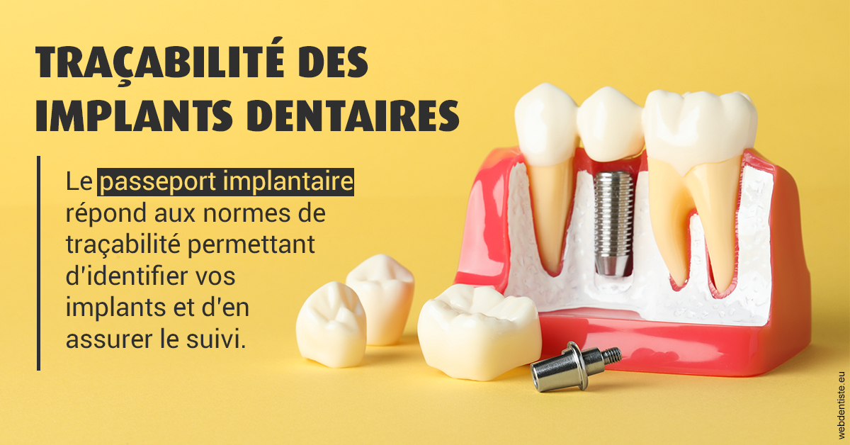https://dr-fabrice-vernet.chirurgiens-dentistes.fr/T2 2023 - Traçabilité des implants 2
