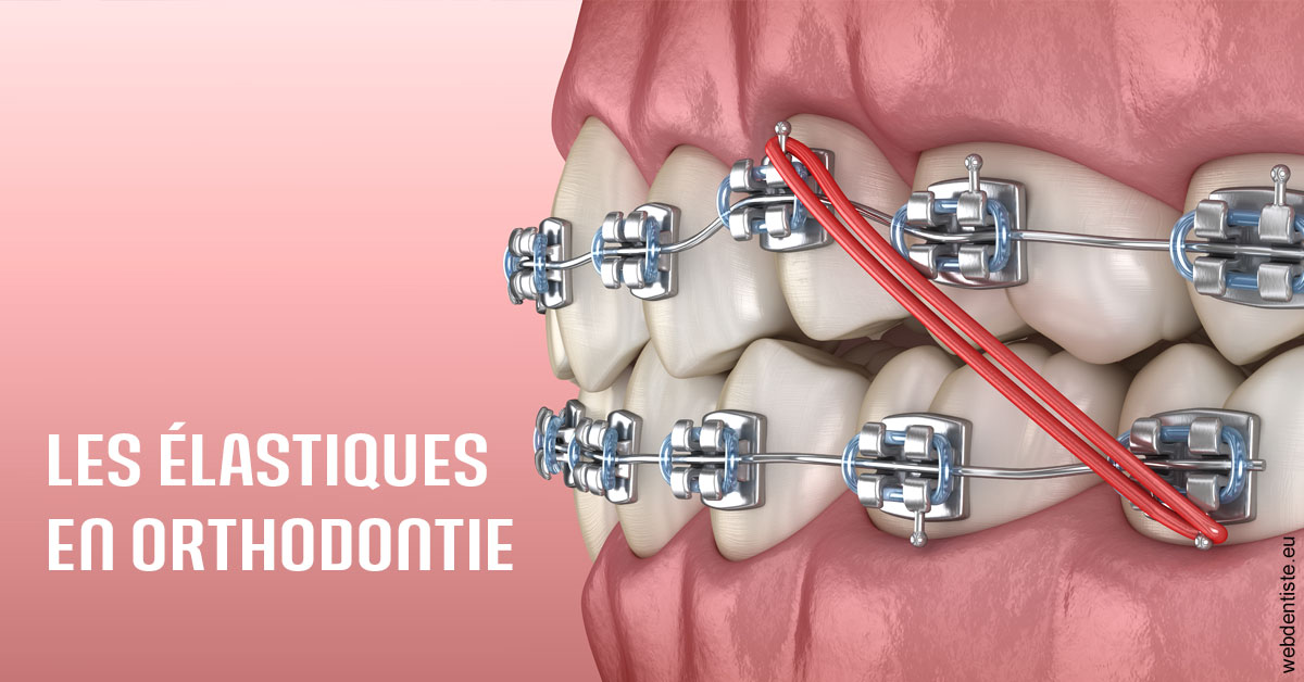 https://dr-fabrice-vernet.chirurgiens-dentistes.fr/Elastiques orthodontie 2