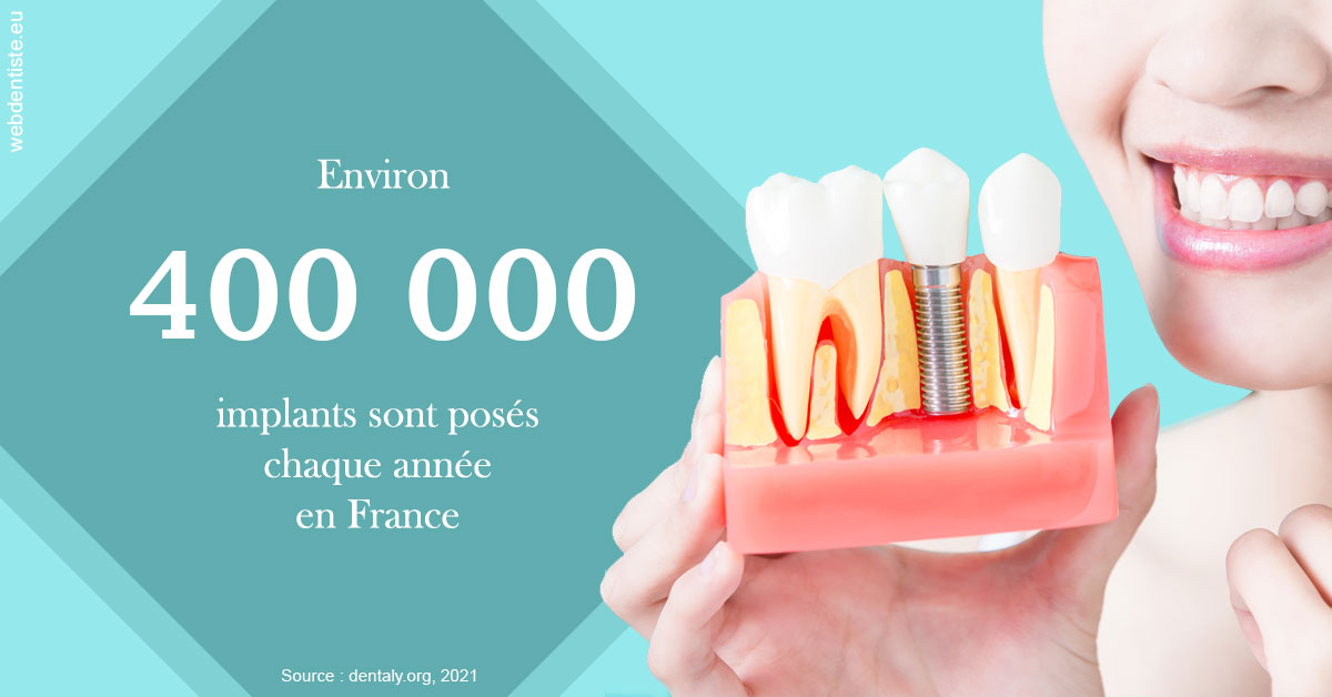 https://dr-fabrice-vernet.chirurgiens-dentistes.fr/Pose d'implants en France 2